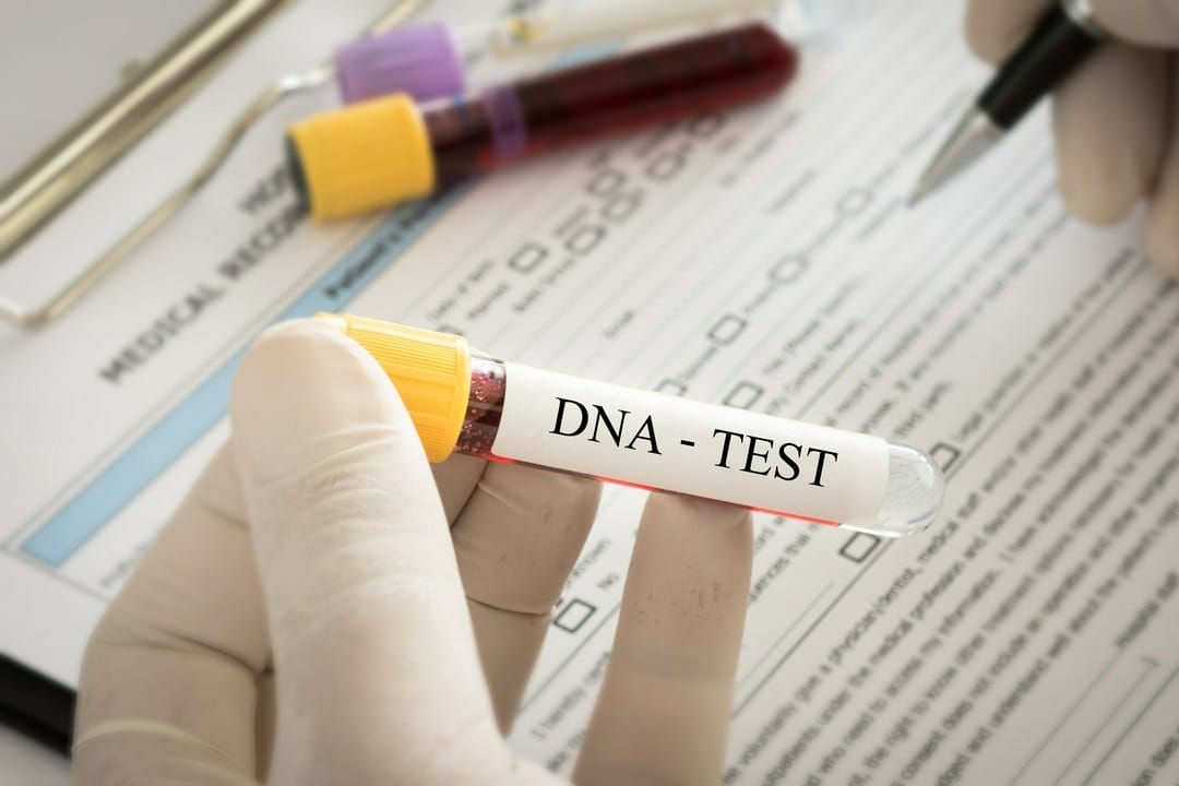 test-DNA